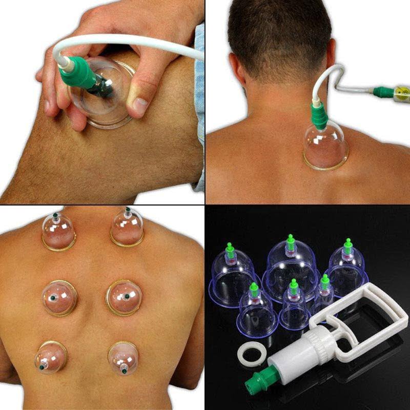 KL Θεραπευτική Συσκευή με Βεντούζες 24τμχ - Pull Out A Vacuum Apparatus 24pcs - Image 2
